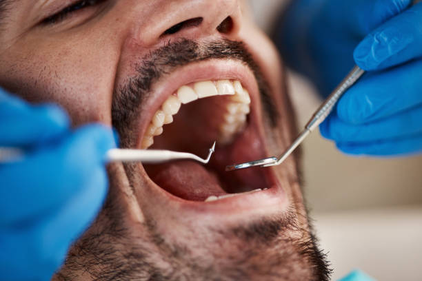 Best Emergency Treatment for Dental Infections or Abscesses in Newtown, PA